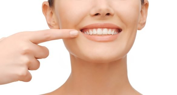 Teeth Straightening